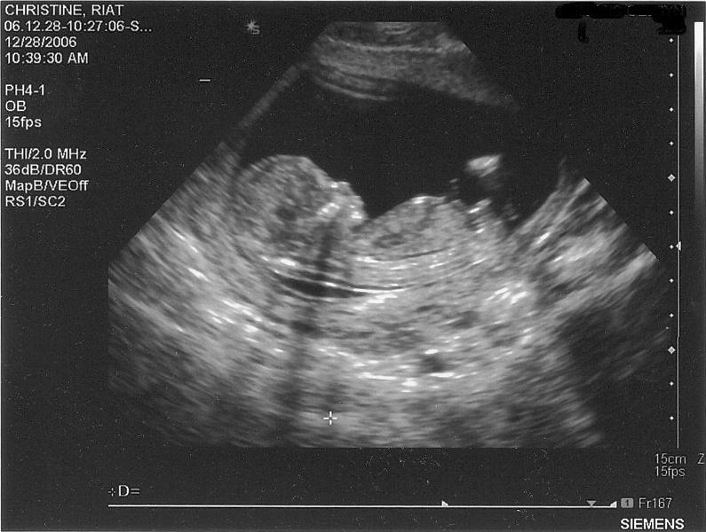 ultrasound122806.jpg